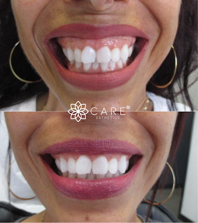 Cary Care Esthetics