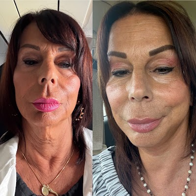 Vega Plastic Surgery & MedSpa