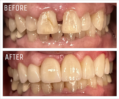 Solace Dental - Bolingbrook, IL