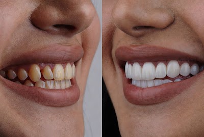 Walden Dental NY