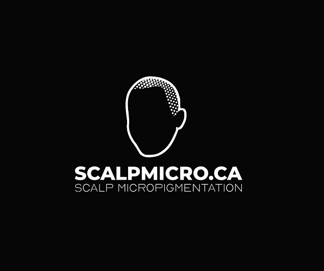 SCALPMICRO Scalp Micropigmentation Calgary
