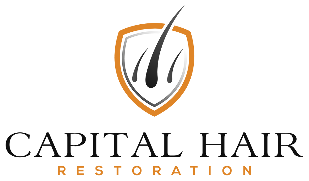 Capital Hair Restoration - Hair Transplant