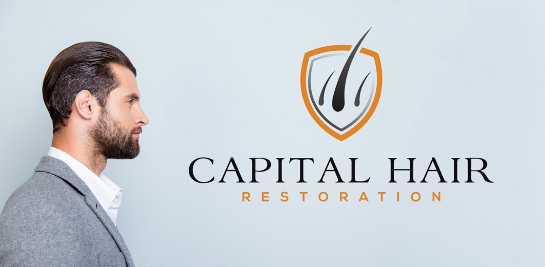 Capital Hair Restoration - Hair Transplant