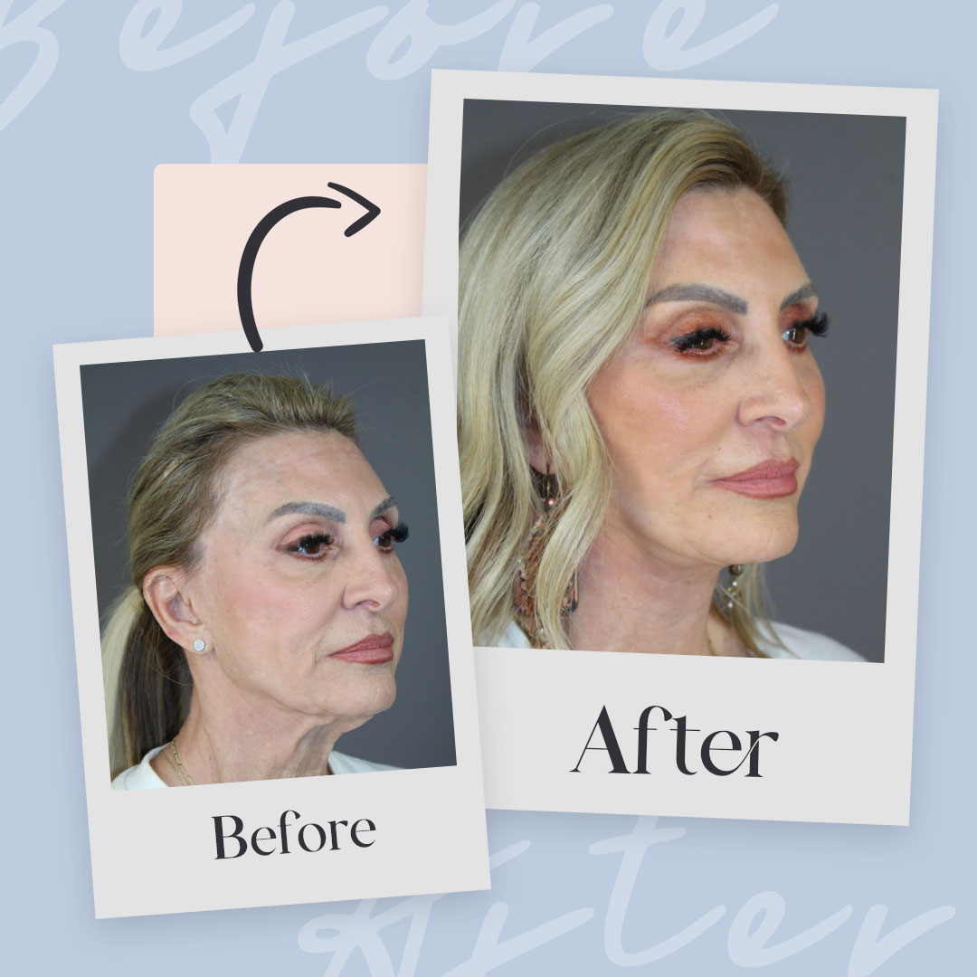 Leo Lapuerta, MD Plastic Surgery