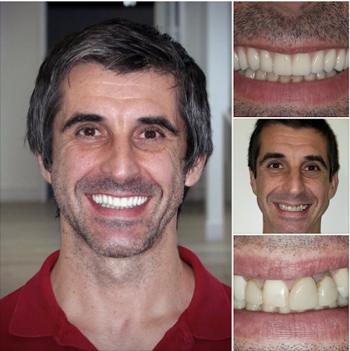 4M Dental Implant Center