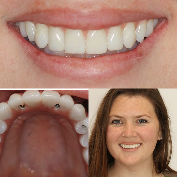 4M Dental Implant Center