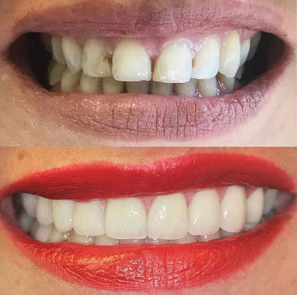 4M Dental Implant Center