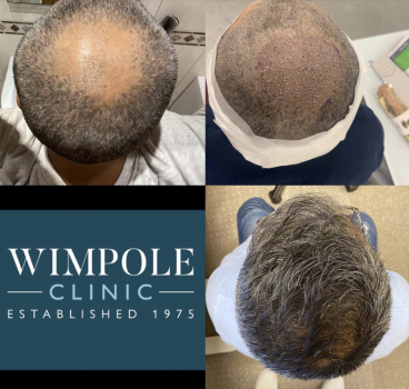 Wimpole Clinic