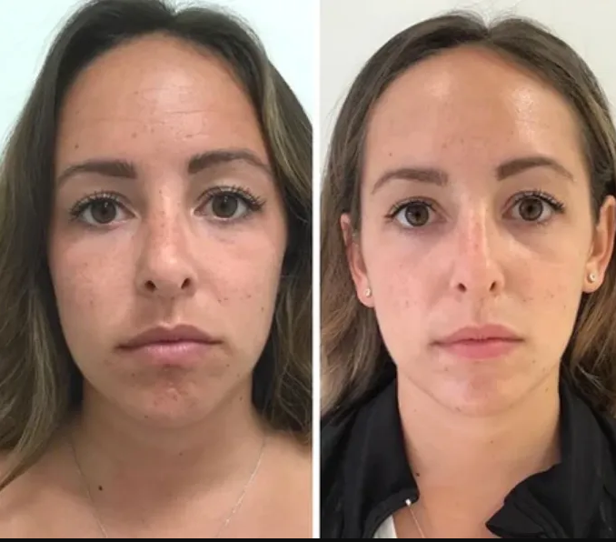 Medical Skin health