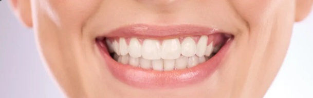 Poplar Dental - Greenwich NW