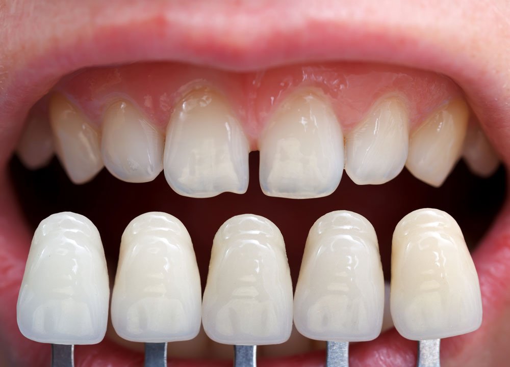 Dentology Dental