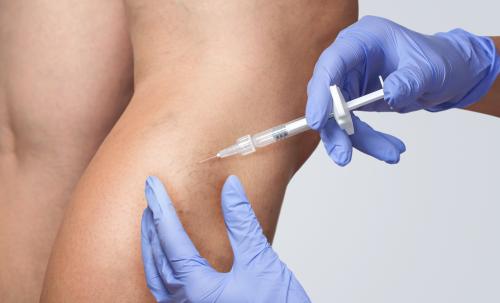 Orris Vein Center