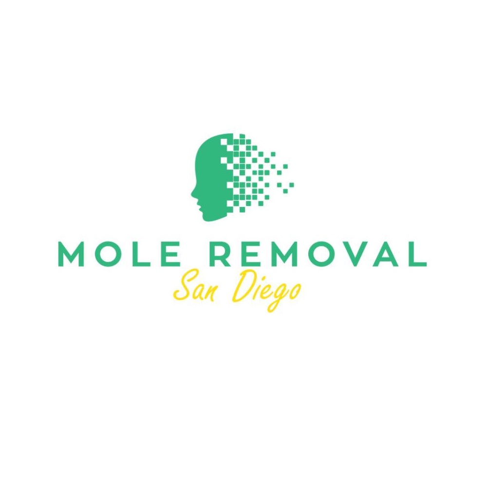 Mole Removal San Diego