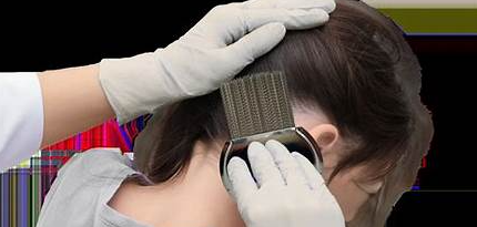 Larger Than Lice | Lice Treatment & Nit Removal Service in New York