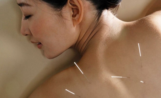 Elemental Wellness Acupuncture