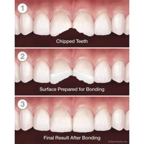 Westgate Dental & Implant Centre