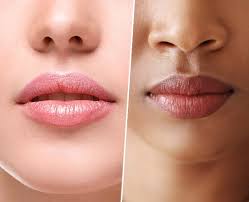 Best Acne Scar Treatment in Hyderabad with Dr. Praneeta Jain