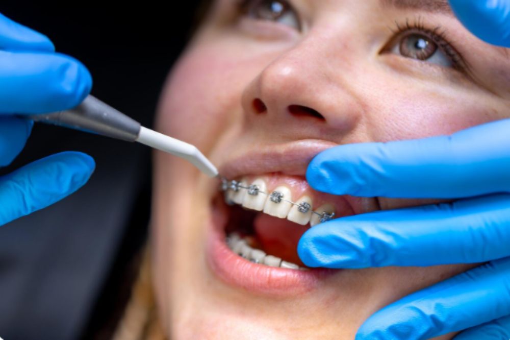 Britton Orthodontics