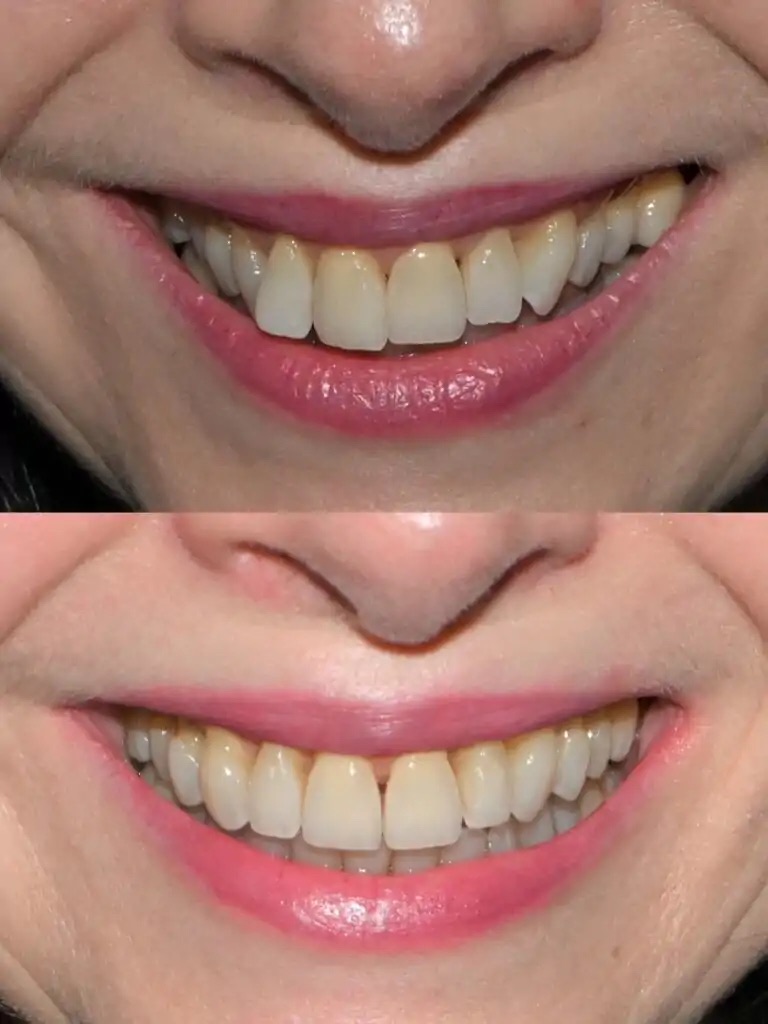 Smiles On Queen | Dentist Bolton