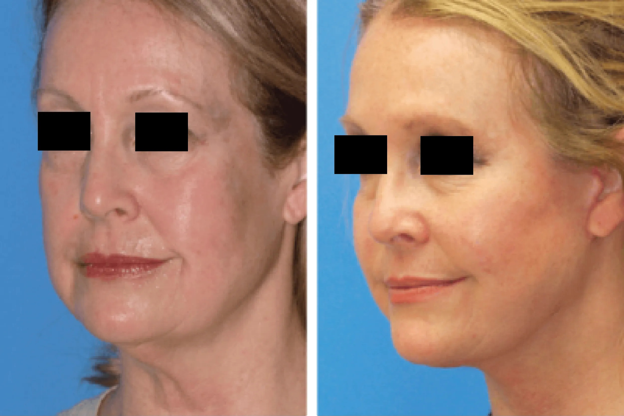 Diepenbrock Facial Cosmetic Surgery