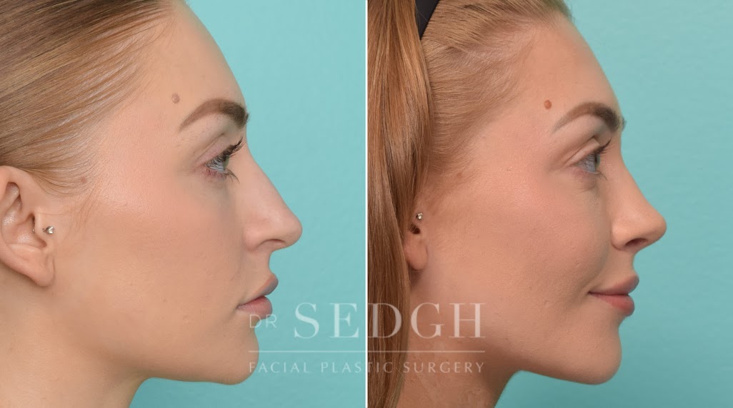 Jacob Sedgh MD