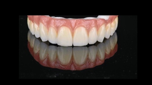 Icon Implant and Dental Center