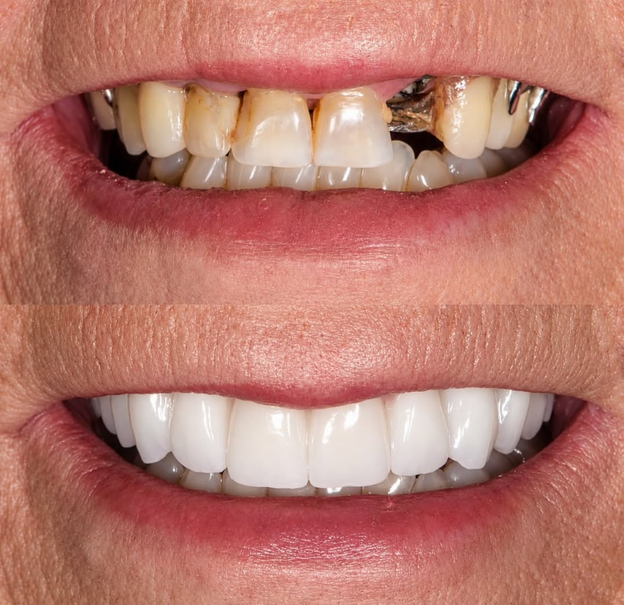 North Hollywood Dentist