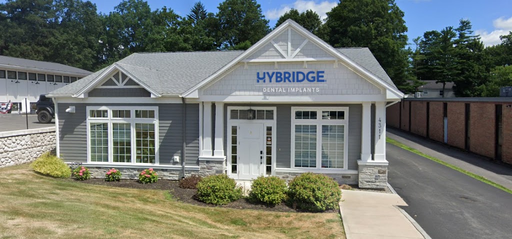 Hybridge Dental Implants