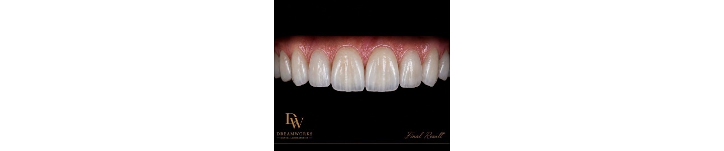 Dreamworks Dental Laboratories